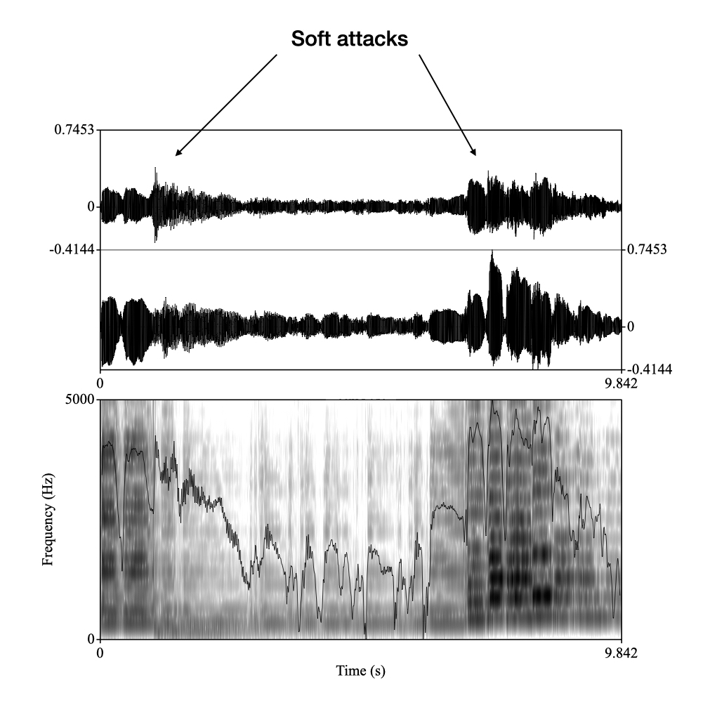 Waveform (amplitude) and spectrogram of soft attacks