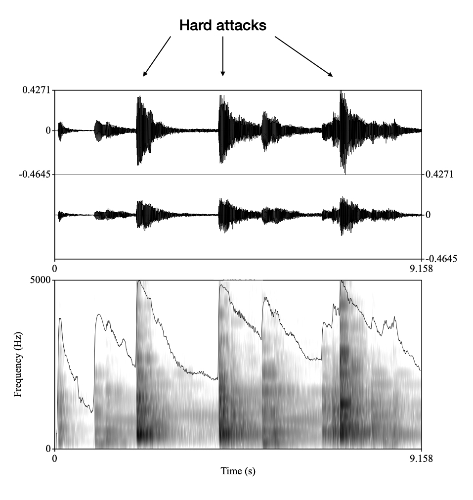 Waveform (amplitude) and spectrogram of hard attacks